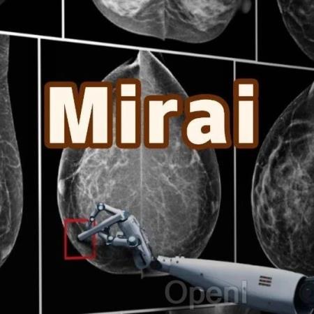 AI模型提早5年预警乳腺癌，MIT研究登Science获LeCun转发（乳腺癌fac方案）